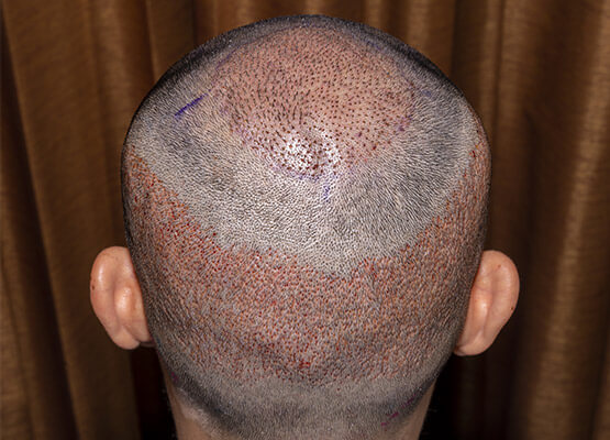 home-before-after-01