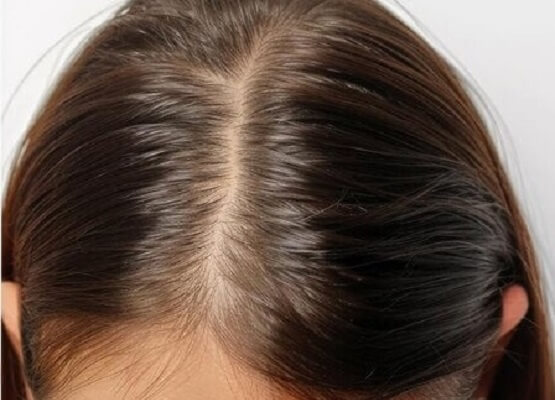 ______hair-loss-growth-woman-comparison-treatment-haircare-texture-care-salon_590464-301774 - نسخة - نسخة - نسخة