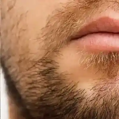 closeup-photo-mans-face-without-beard-with-beard_168410-1898-2