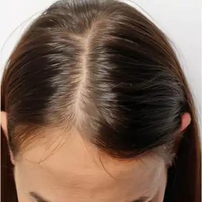 hair-loss-growth-woman-comparison-treatment-haircare-texture-care-salon_590464-301774-نسخة-1